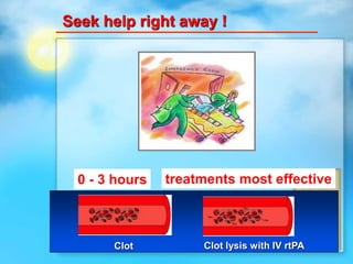 Seek help right away !
0 - 3 hours treatments most effective
Clot lysis with IV rtPAClot
 