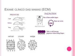 EXAME CLÍNICO DAS MAMAS (ECM)
 