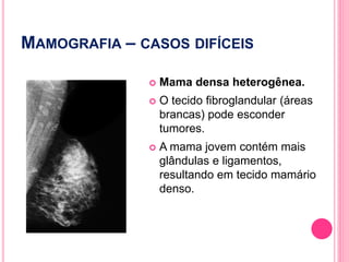 MAMOGRAFIA – CASOS DIFÍCEIS
 Mama densa heterogênea.
 O tecido fibroglandular (áreas
brancas) pode esconder
tumores.
 A mama jovem contém mais
glândulas e ligamentos,
resultando em tecido mamário
denso.
126
 
