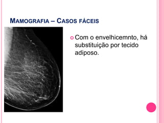 MAMOGRAFIA – CASOS FÁCEIS
 Com o envelhicemnto, há
substituição por tecido
adiposo.
127
 