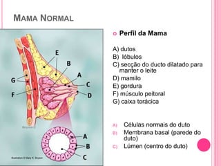 MAMA NORMAL
 Perfil da Mama
A) dutos
B) lóbulos
C) secção do ducto dilatado para
manter o leite
D) mamilo
E) gordura
F) músculo peitoral
G) caixa torácica
A) Células normais do duto
B) Membrana basal (parede do
duto)
C) Lúmen (centro do duto)
Illustration © Mary K. Bryson
 