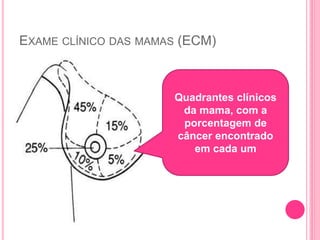 EXAME CLÍNICO DAS MAMAS (ECM)
Quadrantes clínicos
da mama, com a
porcentagem de
câncer encontrado
em cada um
 