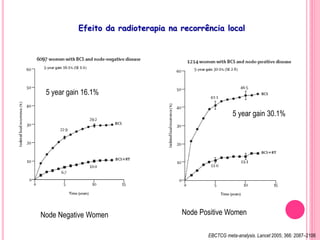 Efeito da radioterapia na recorrência local
EBCTCG meta-analysis. Lancet 2005; 366: 2087–2106
5 year gain 16.1%
5 year gain 30.1%
Node Negative Women Node Positive Women
 