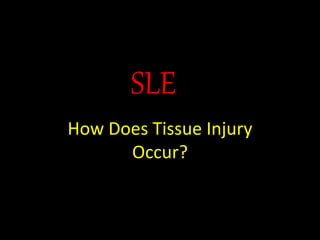 SLE
How Does Tissue Injury
Occur?
 