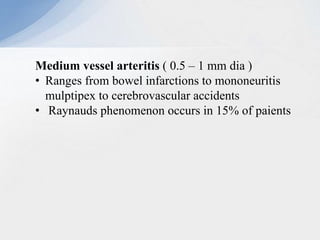 Medium vessel arteritis ( 0.5 – 1 mm dia )
• Ranges from bowel infarctions to mononeuritis
mulptipex to cerebrovascular accidents
• Raynauds phenomenon occurs in 15% of paients
 