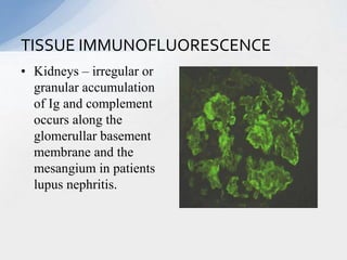 • Kidneys – irregular or
granular accumulation
of Ig and complement
occurs along the
glomerullar basement
membrane and the
mesangium in patients
lupus nephritis.
TISSUE IMMUNOFLUORESCENCE
 