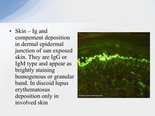 • Skin – Ig and
compement deposition
in dermal epidermal
junction of sun exposed
skin. They are IgG or
IgM type and appear as
brightly staining
homogenous or granular
band. In discoid lupus
erythematosus
deposition only in
involved skin
 