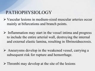  Vascular lesions in medium-sized muscular arteries occur
mainly at bifurcations and branch points.
 Inflammation may start in the vessel intima and progress
to include the entire arterial wall, destroying the internal
and external elastic lamina, resulting in fibrinoidnecrosis.
 Aneurysms develop in the weakened vessel, carrying a
subsequent risk for rupture and hemorrhage.
 Thrombi may develop at the site of the lesions
PATHOPHYSIOLOGY
 