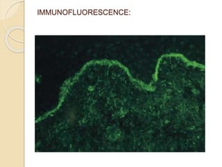 IMMUNOFLUORESCENCE:
 