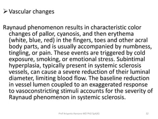 Vascular changes 
Raynaud phenomenon results in characteristic color 
changes of pallor, cyanosis, and then erythema 
(white, blue, red) in the fingers, toes and other acral 
body parts, and is usually accompanied by numbness, 
tingling, or pain. These events are triggered by cold 
exposure, smoking, or emotional stress. Subintimal 
hyperplasia, typically present in systemic sclerosis 
vessels, can cause a severe reduction of their luminal 
diameter, limiting blood flow. The baseline reduction 
in vessel lumen coupled to an exaggerated response 
to vasoconstricting stimuli accounts for the severity of 
Raynaud phenomenon in systemic sclerosis. 
Prof Ariyanto Harsono MD PhD SpA(K) 32 
 