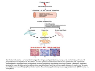 Overall scheme illustrating a current understanding of SSc pathogenesis. Hypothetical sequence of events involved in tissue fibrosis and 
fibroproliferative vasculopathy in SSc. An unknown causative agent induces activation of immune and inflammatory cells in genetically 
predisposed hosts resulting in chronic inflammation. Activated inflammatory and immune cells secrete cytokines, chemokines, and growth 
factors which cause fibroblast activation, differentiation of endothelial and epithelial cells into myofibroblasts, and recruitment of fibrocytes 
from the bone marrow and the peripheral blood circulation. The activated myofibroblasts produce exaggerated amounts of ECM resulting in 
tissue fibrosis. 
8 
 