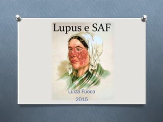 Lupus e SAF
Luiza Fuoco
2015
 