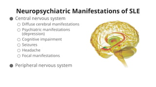 Neuropsychiatric Manifestations of SLE
● Central nervous system
○ Diffuse cerebral manifestations
○ Psychiatric manifestations
(depression)
○ Cognitive impairment
○ Seizures
○ Headache
○ Focal manifestations
● Peripheral nervous system
 