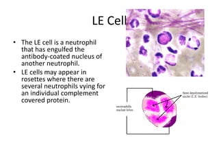 LE Cell
• The LE cell is a neutrophil
that has engulfed the
antibody-coated nucleus of
another neutrophil.
• LE cells may appear in
rosettes where there are
several neutrophils vying for
an individual complement
covered protein.
 