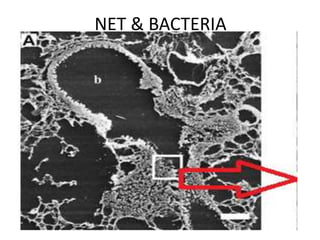NET & BACTERIA
 