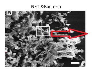 NET &Bacteria
 