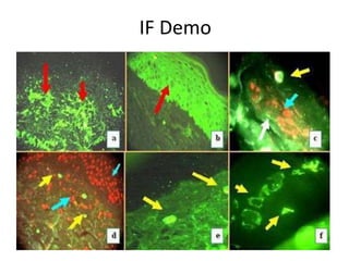 IF Demo
 