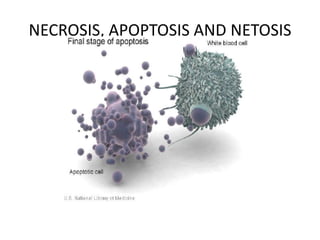 NECROSIS, APOPTOSIS AND NETOSIS
 
