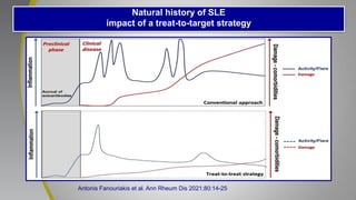 Natural history of SLE
impact of a treat-to-target strategy
Antonis Fanouriakis et al. Ann Rheum Dis 2021;80:14-25
 