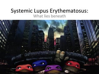 Systemic	
  Lupus	
  Erythematosus:	
  
What	
  lies	
  beneath	
  
 