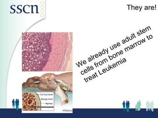 They are!


                       tem
                   lt s to
                 du ow
              e a a rr
            us m
          dy ne
        ea bo
     alr m
  e fro emia
W ls
 ce tl Leuk
   tre a
 