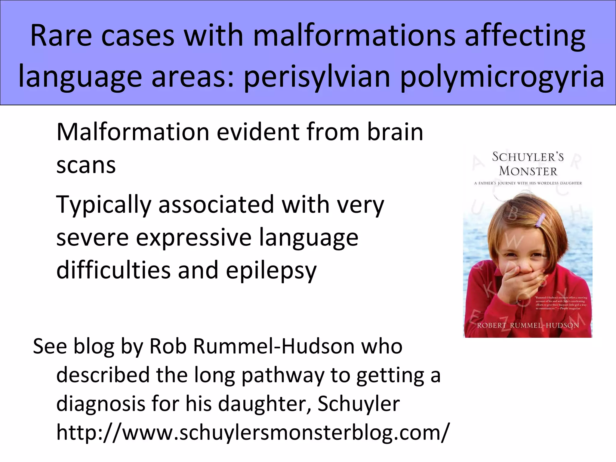 Rare cases with malformations affecting
language areas: perisylvian polymicrogyria
   Malformation evident from brain
   scans
   Typically associated with very
   severe expressive language
   difficulties and epilepsy

 See blog by Rob Rummel-Hudson who
   described the long pathway to getting a
   diagnosis for his daughter, Schuyler
   http://www.schuylersmonsterblog.com/
 