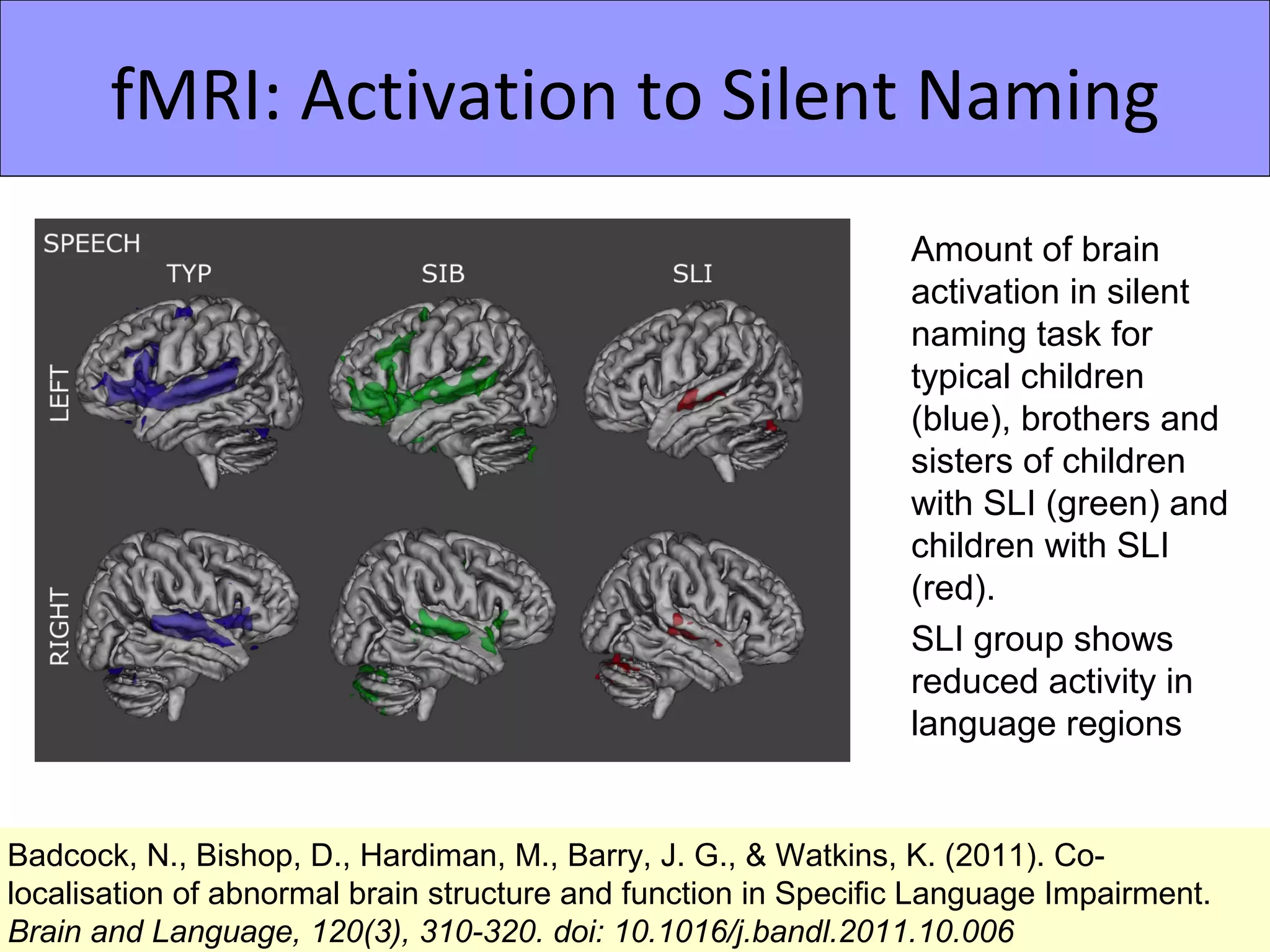 fMRI: Activation to Silent Naming
                                                                Amount of brain
                                                                activation in silent
                                                                naming task for
                                                                typical children
                                                                (blue), brothers and
                                                                sisters of children
                                                                with SLI (green) and
                                                                children with SLI
                                                                (red).
                                                                SLI group shows
                                                                reduced activity in
                                                                language regions


Badcock, N., Bishop, D., Hardiman, M., Barry, J. G., & Watkins, K. (2011). Co-
localisation of abnormal brain structure and function in Specific Language Impairment.
Brain and Language, 120(3), 310-320. doi: 10.1016/j.bandl.2011.10.006
 