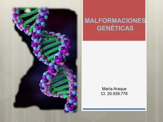 MALFORMACIONES
GENÉTICAS
María Araque
CI. 20.939.778
 