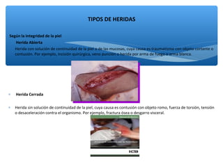Según la integridad de la piel
∗ Herida Abierta
∗ Herida con solución de continuidad de la piel o de las mucosas, cuya causa es traumatismo con objeto cortante o
contusión. Por ejemplo, incisión quirúrgica, veno punción o herida por arma de fuego o arma blanca.
∗ Herida Cerrada
∗ Herida sin solución de continuidad de la piel, cuya causa es contusión con objeto romo, fuerza de torsión, tensión
o desaceleración contra el organismo. Por ejemplo, fractura ósea o desgarro visceral.
TIPOS DE HERIDAS
 