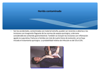 ∗ Son las accidentales, contaminadas con material extraño, pueden ser recientes o abiertas o las
incisiones con trasgresión flagrante de las normas de asepsia quirúrgica, o derrame
considerable de contenido gastrointestinal. También se incluyen las incisiones con inflamación
aguda no supurativa, fracturas o heridas con más de cuatro horas de evolución, así se haya
iniciado el tratamiento quirúrgico. La probabilidad relativa de infección es del 10 al 15%.
Herida contaminada
 