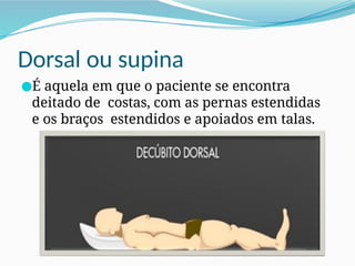 Dorsal ou supina
●É aquela em que o paciente se encontra
deitado de costas, com as pernas estendidas
e os braços estendidos e apoiados em talas.
 
