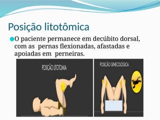 Posição litotômica
●O paciente permanece em decúbito dorsal,
com as pernas flexionadas, afastadas e
apoiadas em perneiras.
 