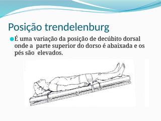 Posição trendelenburg
●É uma variação da posição de decúbito dorsal
onde a parte superior do dorso é abaixada e os
pés são elevados.
 