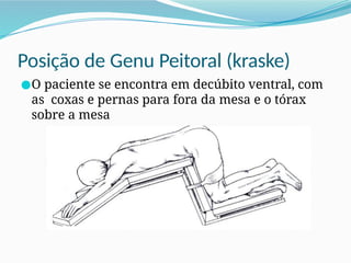 Posição de Genu Peitoral (kraske)
●O paciente se encontra em decúbito ventral, com
as coxas e pernas para fora da mesa e o tórax
sobre a mesa
 