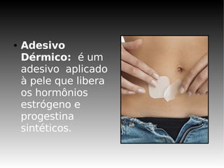 ●   Adesivo
    Dérmico: é um
    adesivo aplicado
    à pele que libera
    os hormônios
    estrógeno e
    progestina
    sintéticos.
 