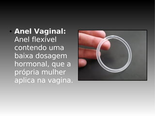 ●   Anel Vaginal:
    Anel flexível
    contendo uma
    baixa dosagem
    hormonal, que a
    própria mulher
    aplica na vagina.
 