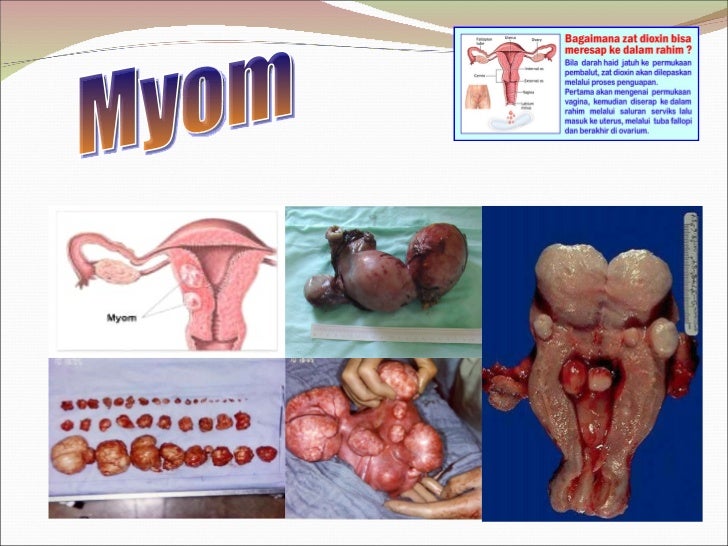 Presentasi Pembalut In3