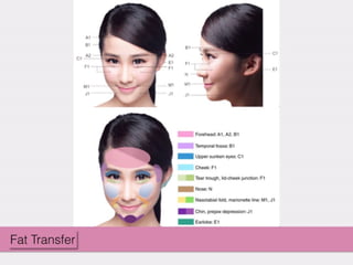 20150205 Anti-Aging & Fat Grafting Speech