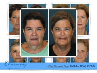 20150205 Anti-Aging & Fat Grafting Speech