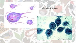Giardia lambia
 