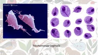 Tricchomonas vaginalis
 