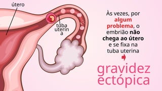 útero
tuba
uterin
a
Às vezes, por
algum
problema, o
embrião não
chega ao útero
e se fixa na
tuba uterina
gravidez
ectópica
 