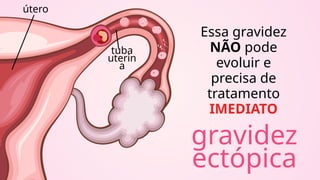 útero
tuba
uterin
a
Essa gravidez
NÃO pode
evoluir e
precisa de
tratamento
IMEDIATO
gravidez
ectópica
 