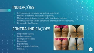INDICAÇÕES
⬥ Incremento na circulação sanguínea superficial;
⬥ Melhora o trofismo dos vasos sanguíneos;
⬥ Melhora a nutrição dos tecidos e eliminação das toxinas;
⬥ Reestruturação do tecido conjuntivo e remodelamento corporal;
⬥ Diminuição das fibroses.
119
CONTRA-INDICAÇÕES
⬥ Fragilidade capilar;
⬥ Lesões cutâneas;
⬥ Doenças infecciosas;
⬥ Neoplasias;
⬥ Hipertensão;
⬥ Pós operatório imediato;
⬥ Flacidez.
 