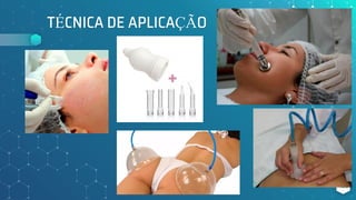 TÉCNICA DE APLICAÇÃO
120
 