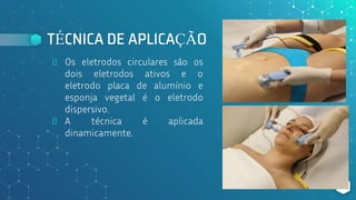 TÉCNICA DE APLICAÇÃO
⬥ Os eletrodos circulares são os
dois eletrodos ativos e o
eletrodo placa de alumínio e
esponja vegetal é o eletrodo
dispersivo.
⬥ A técnica é aplicada
dinamicamente.
135
 