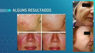 ALGUNS RESULTADOS
158
 