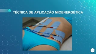 TÉCNICA DE APLICAÇÃO MIOENERGÉTICA
29
 
