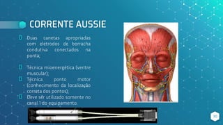 CORRENTE AUSSIE
⬥ Duas canetas apropriadas
com eletrodos de borracha
condutiva conectados na
ponta;
⬥ Técnica mioenergética (ventre
muscular);
⬥ Técnica ponto motor
(conhecimento da localização
correta dos pontos);
⬥ Deve ser utilizado somente no
canal 1 do equipamento.
30
 