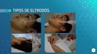 TIPOS DE ELTRODOS
85
 